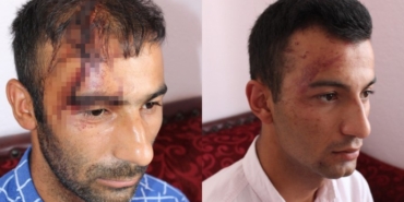 Konya’da Iğdırlı aileye ırkçı saldırı! - igdirli aileye irkci saldiri