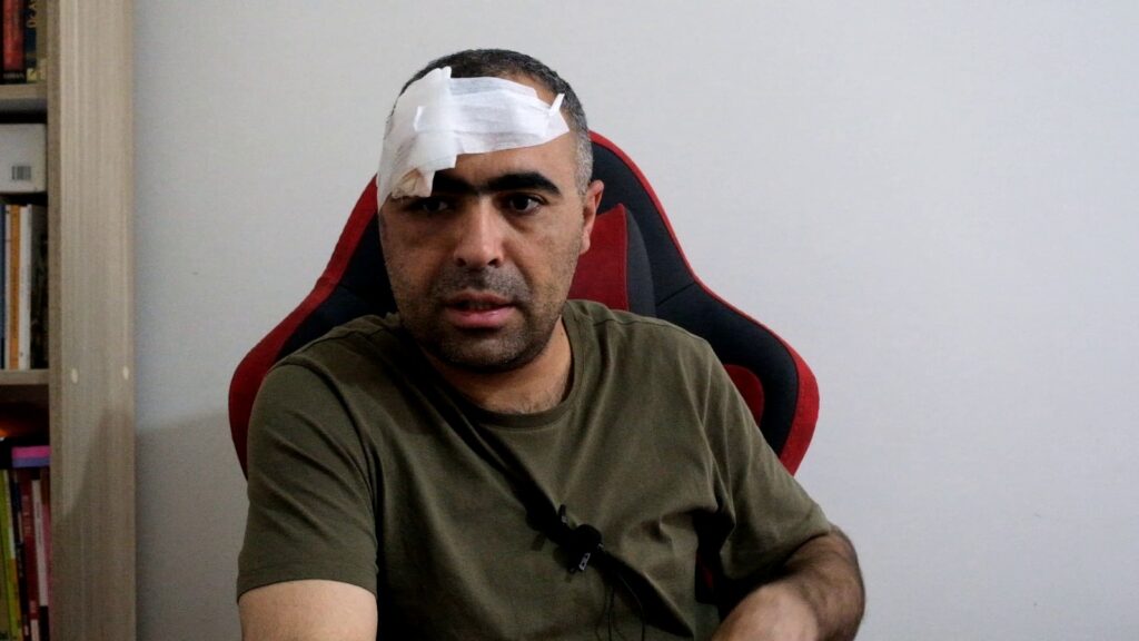 Gazeteci Sinan Aygül: Pervasızca bir saldırıydı! - gazeteci sinan aygul saldiri rop 2