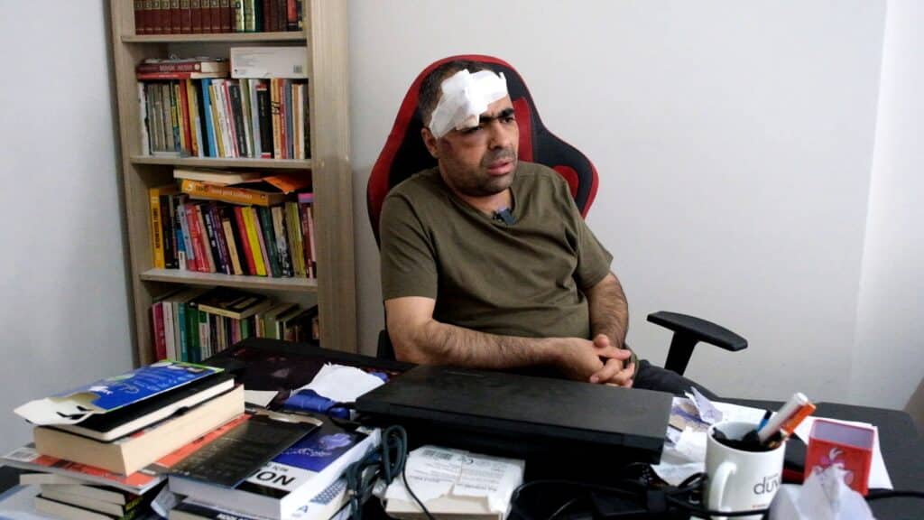 Gazeteci Sinan Aygül: Pervasızca bir saldırıydı! - gazeteci sinan aygul saldiri rop 4