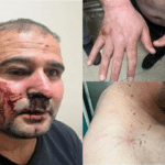 Hakkari’de polis şiddeti: Gözaltında darp edildi